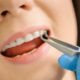 close-up-ceramic-brackets-dental-clinic_10069-155