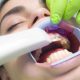 dentist scanning patients teeth with iTero scanner