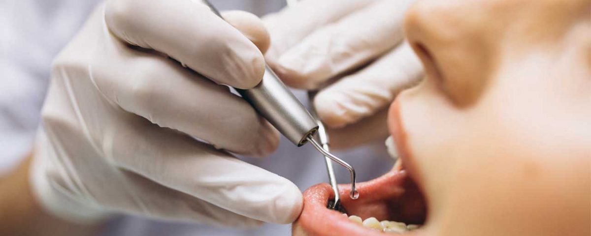 dentist checking for periodontal disease